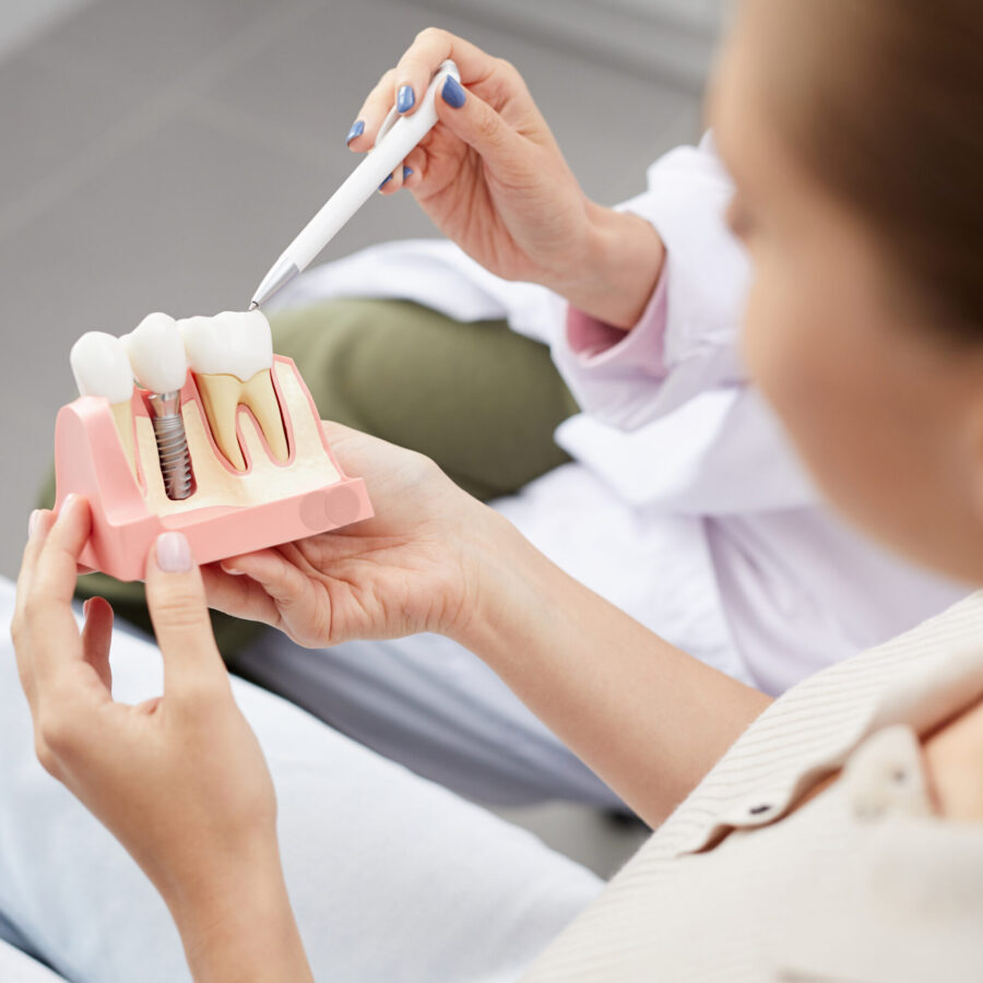 Implantes dentales
